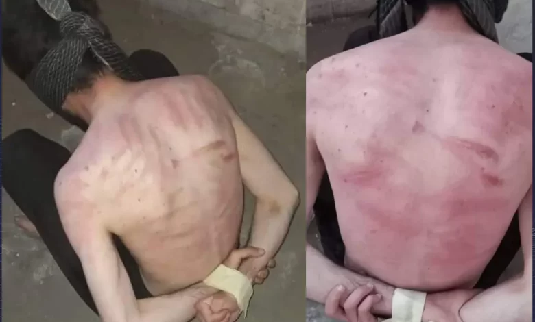 با احمد علی در زندان طالبان چه گذشت!؟ 1 شکنجه مردم توسط طالبان