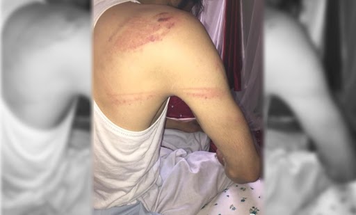 گروه طالبان یک جوان دانشجو را به دلیل حمل کتاب"احمدشاه مسعود" در قندهار شکنجه کردند 1 شکنجه